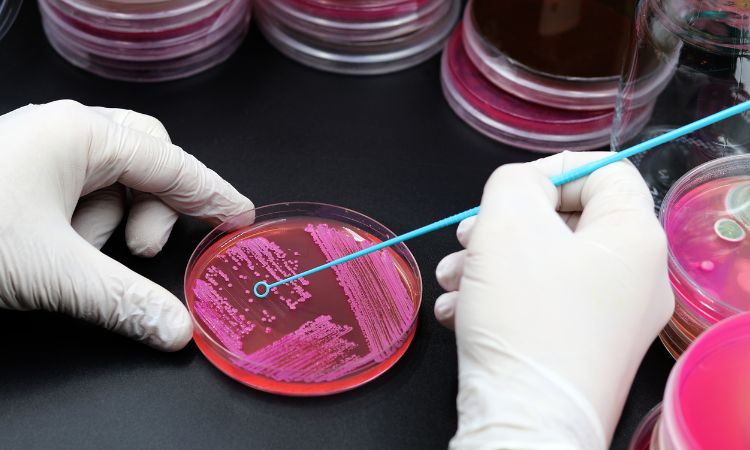 Explora qué son los procesos microbiológicos, sus tipos naturales y aplicados, y las etapas clave del estudio microbiológico.
