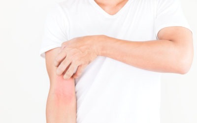 Patologías dermatológicas: las más comunes